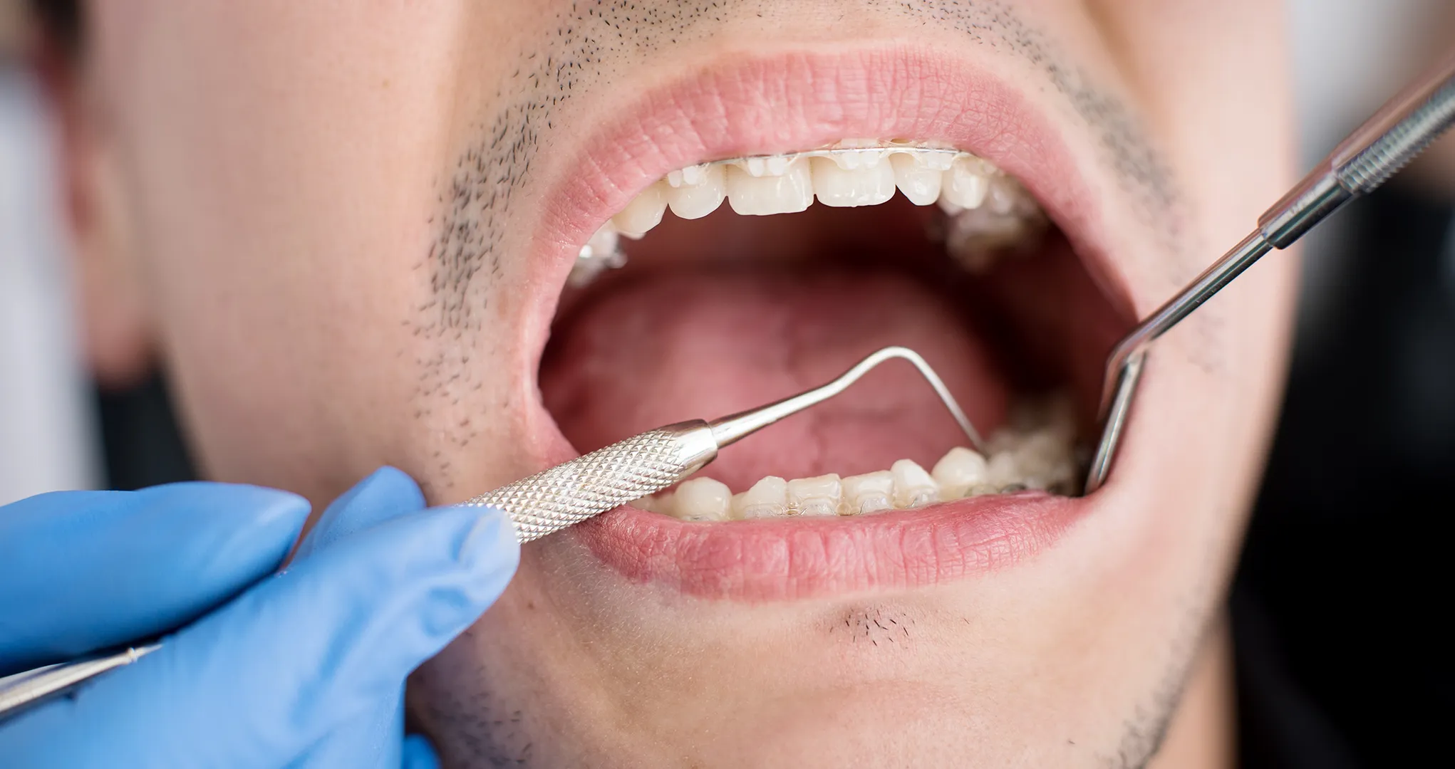 cirujano oral maxilofacial dentista doctor raul vives